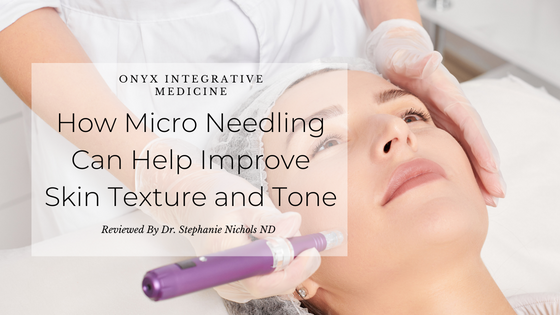 How Micro Needling Can Help Improve Skin Texture and Tone