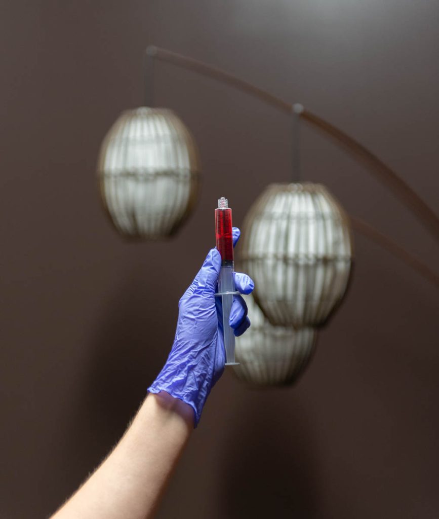 Doctor holding prolotherapy injection