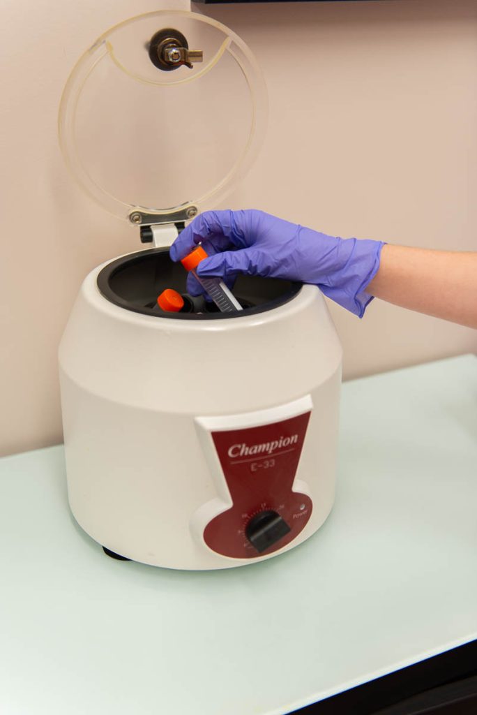 Spins up PRP for usage called the prp injection in centrifuge.